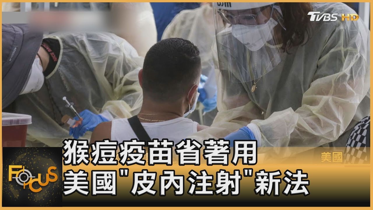 猴痘疫苗省著用　美國「皮內注射」新法