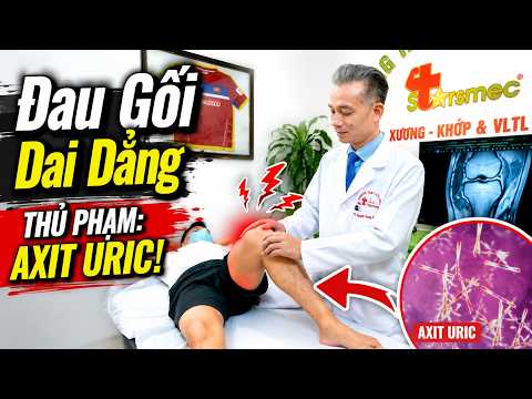 Đau Gối Không Khỏi, Chụp Phim Vẫn Đẹp? Thủ Phạm Axit Uric