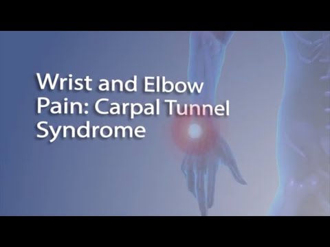 Carpal Tunnel Syndrome | FAQ with Dr. Sophia Strike
