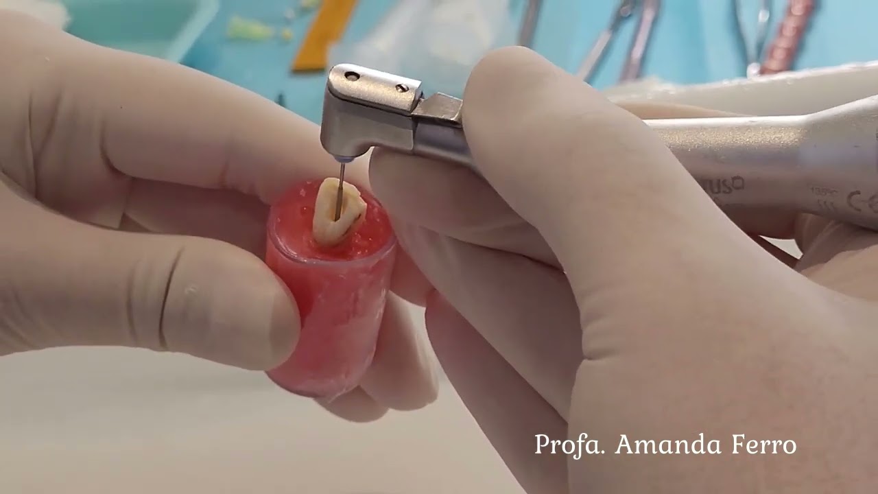 AULA - Endodontia - abertura coronária e medicação intracanal