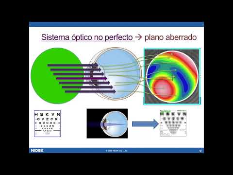 Taller OPD Scan III