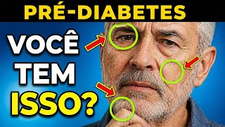 TODOS com PRÉ-DIABETES Têm ISSO em Comum! 8 Sinais Iniciais de Açúcar Alto no Sangue
