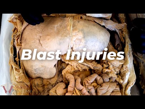 爆炸對人體的影響 (What Explosions Do to the Body)