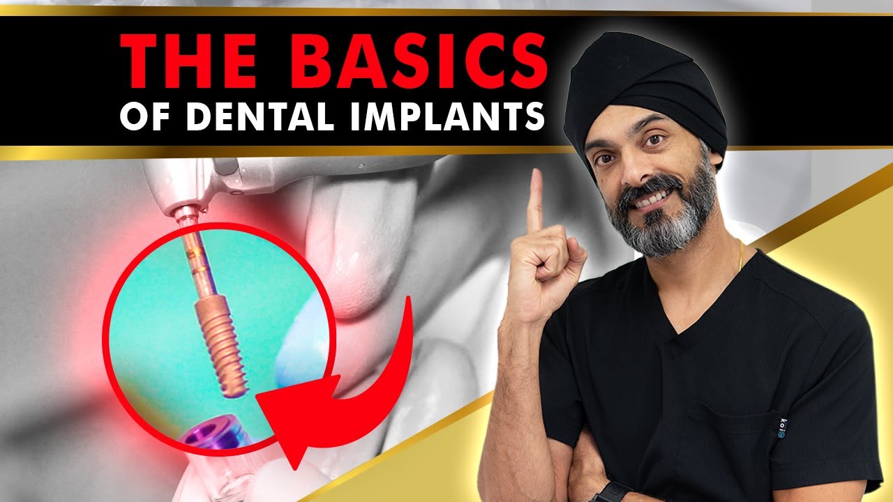  A Month Dental Implants