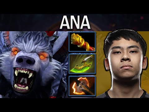 Ursa Dota 2 Gameplay Ana with 29 Kills and Battlefury