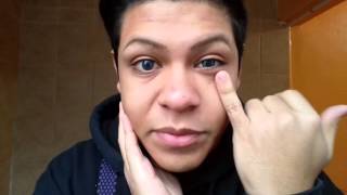 Contact lens sizes - 14mm, 14.2mm and 15mm