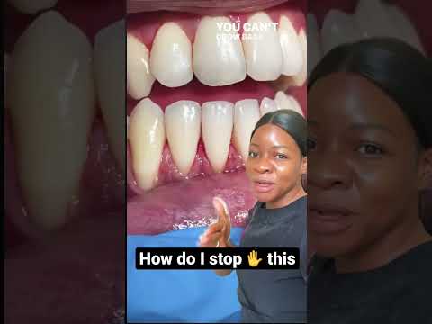 stop gums from receding #shorts #dentist #viral #youtube #videooftheday #teeth #smile #foryou