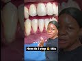 This stops gums from receding #shorts #dentist #viral #youtube #videooftheday #teeth #smile #foryou