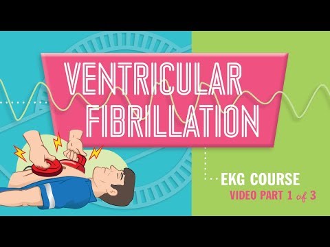 Ventricular fibrillation ( VF or V fib ) part 1 of 3 causes, symptoms & pathophysiology