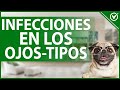🐶 Infecciones en los Ojos de los Perros - Tipos, Causas, Tratamiento y Prevención 👀🐶
