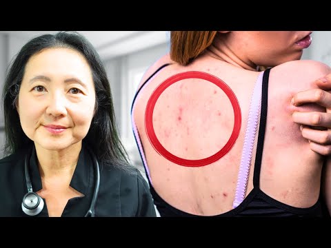 5 Symptoms to Never Ignore In Your Abdomen