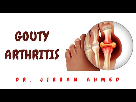 RHEUMATOID ARTHRITIS II BONES AND SOFT TISSUE II ARTHRITIS II ROBBINS 10TH E II PATHOLOGY LECTURES
