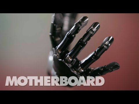 Inspirational Prosthetic Stories