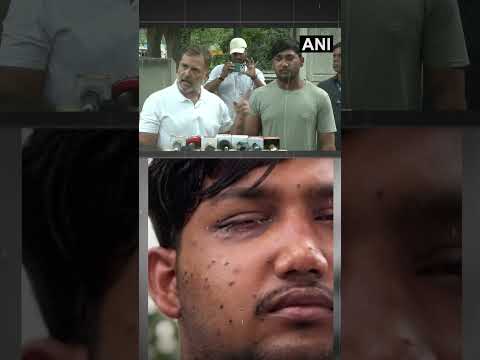 शिक्षा मंत्री पर राहुल का बड़ा आरोप- 'अपराधी हैं'! Pellet Gun पीड़ित के साथ पहुंचे राहुल!