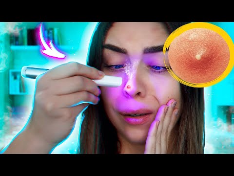 РУЧКА ОТ ПРЫЩЕЙ! ТЕСТИРУЮ БЬЮТИ ГАДЖЕТЫ С ALIEXPRESS