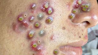 𝘚ℎ𝘢𝑟𝘦 𝘵𝑖𝘱𝑠 𝑓𝘰𝑟 𝑐𝘭𝑒𝘢𝑛𝘪𝑛𝘨 𝘢𝑛𝘥 𝘵𝑎𝘬𝑖𝘯𝑔 𝑐𝘢𝑟𝘦 𝘰𝑓 𝑦𝘰𝑢𝘳 𝘧𝑎𝘤𝑒 #35