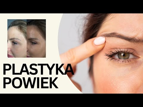 Piotr  Turkowski-50