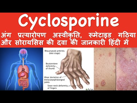 Psorid 50 Mg Capsules