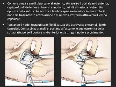 Mani lussazione articolare Periartrite alla caviglia foto congiunta