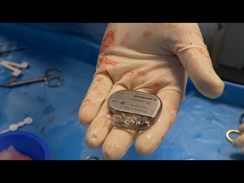 Stimulatorul cardiac și defibrilatorul cardiac în aritmiile cardiace