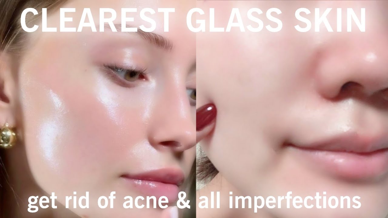 「experimental」DRASTICALLY CLEARER SKIN + get rid of acne & all imperfections {❌PURGING}