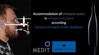 AG Artex Facebow + intraoral scans - mount into virtual articulator. TUTORIAL