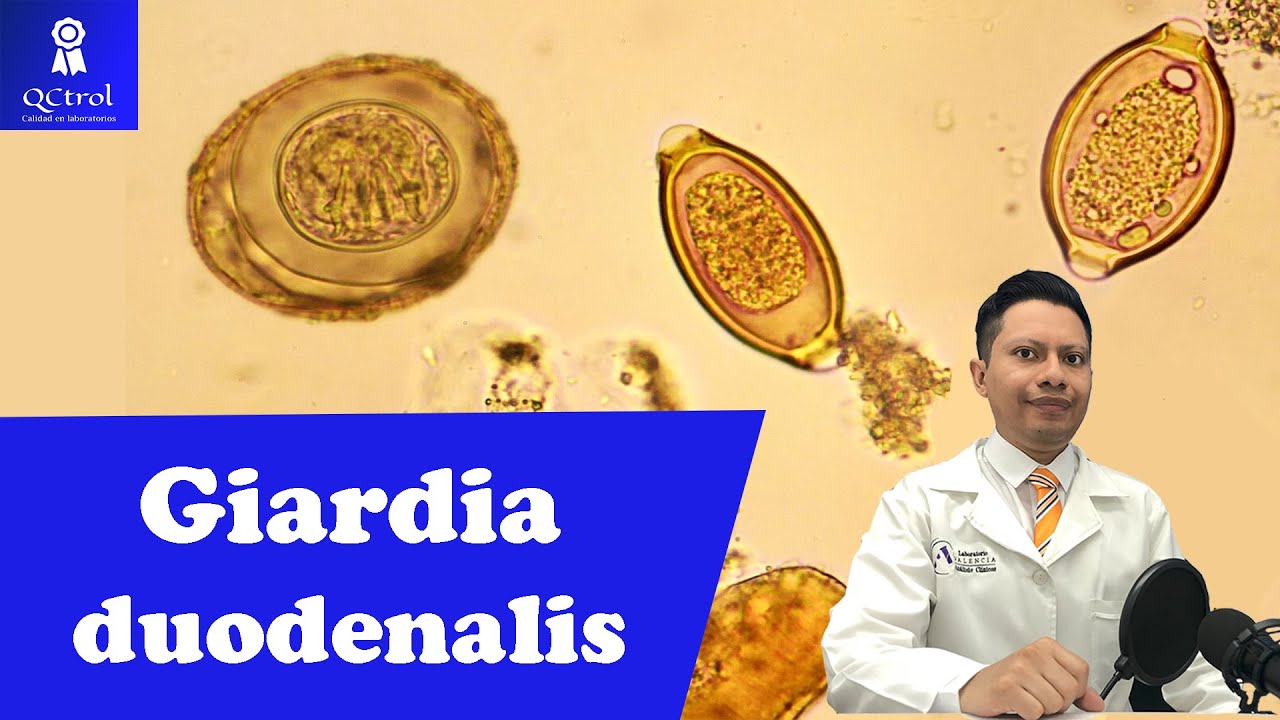 Meet Giardia duodenalis: Morphology and KEYS for its identification 🔬
