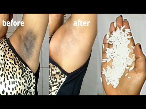 IN 5 MINUTE REMOVE DARK UNDER ARMS  USING RICE 100% WORKING