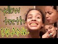 Yellow Teeth Prank!