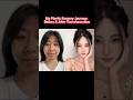 My Plastic Surgery Journey Before After Transformation Facetransformation Beautytransformed