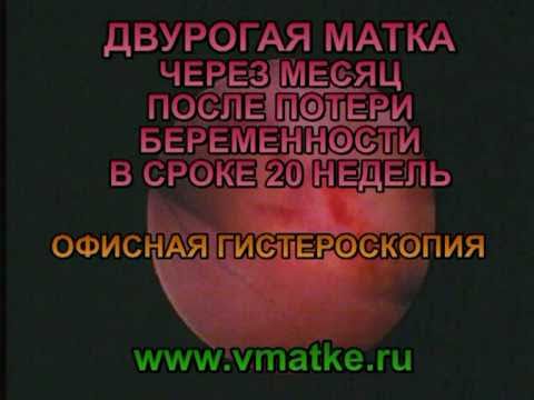Бандаж на коленный сустав 8516 Фонофорез с гидрокортизоном на тазобедренный сустав