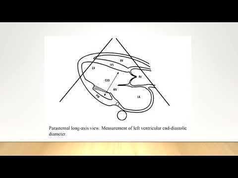 A new approach to assessment of left ventricular contractility – simplified LV systolic funct. index