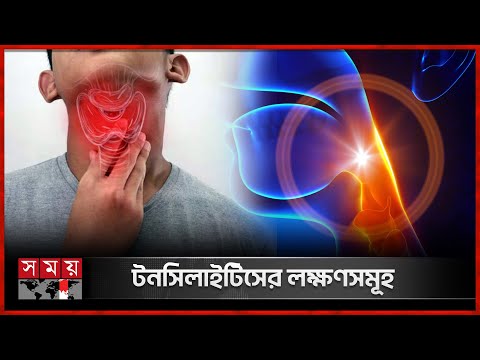 টনসিলাইটিস কী? | Tonsil Problems | Tonsillitis | Tonsillitis Symptoms | Somoy TV