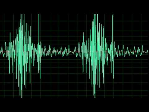 Aortic Stenosis- normal speed