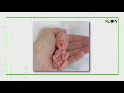 Fetus video