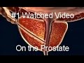 Best Prostate Video - YouTube