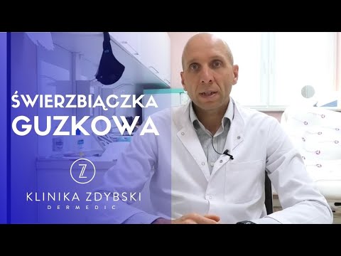 Dermatolog mówi o: Świerzbiączka guzkowa