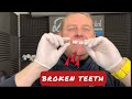 Broken ALL-ON-4 DENTAL IMPLANT SOLUTIONS