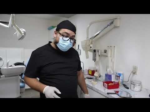 All On Four Smile Restoration with Dental Implants in Mexico-Testimonial