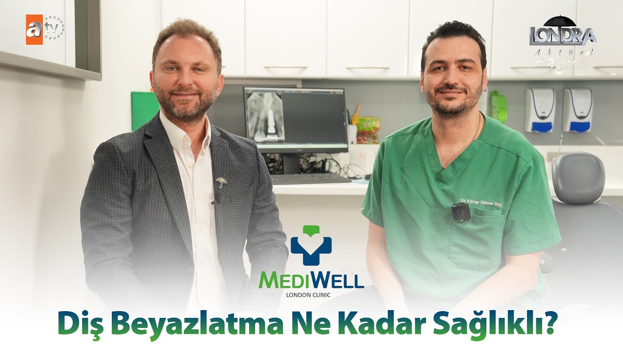 Diş beyazlatma ne kadar sağlıklı? / Londra Aktüel 339. Bölüm