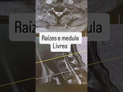 Marco Aurélio Severo Da Silva Versiani-102