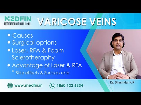 Varicose Veins Treatment Options: EVLT (Laser), RFA and Sclerotherapy