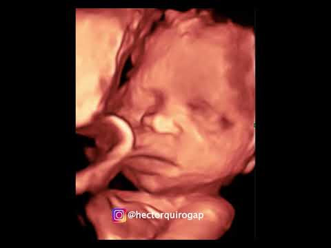 4D ultrasound at 27 weeks of pregnancy
