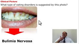 Psychiatry Quick Review (8)    #usmle #internal_medicine #cme #محاضرات_باطنة #medicine