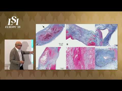 Steven Mickelsen, Del Medtech - Innovative Medical Technology Development | LSI Europe '25