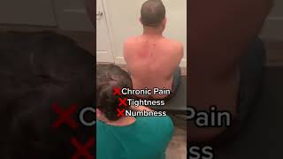 #upperbackpain ❌ MARKS THE SPOT! Shockwave Therapy to Remove the Adhesions