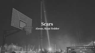 【和訳】Scars-Alesso, Ryan Tedder