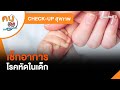 อาการ