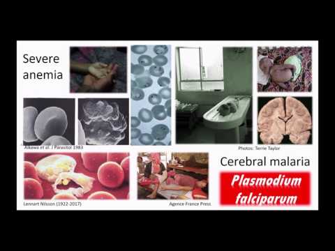 Institute for Global Health Seminar Series Chris Plowe