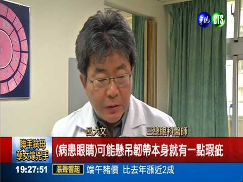 眼睛動過刀 坐雲霄飛車突視茫茫